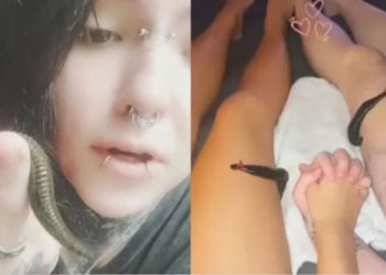 TikToker alimenta sanguessugas com o próprio sangue; veja o vídeo