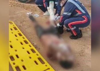 Ensanguentado e com fratura exposta jovem é encontrado em estrada; veja vídeo