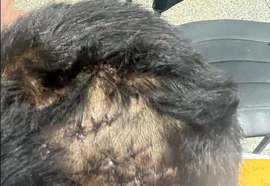 Criança de 6 anos tem cabeça quebrada após comer o mingau da irmã