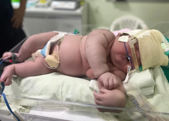 Em Parintins, bebê nasce com 7,3 kg e mais de meio metro