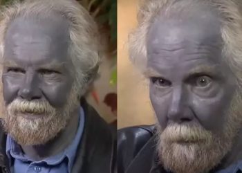 Um homem se tornou amplamente conhecido como ‘Papa Smurf’, ganhou fama da noite para o dia na internet devido à sua impressionante pele azul.