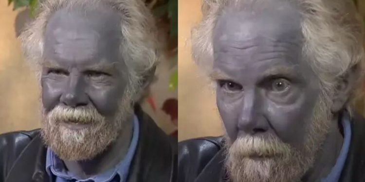 Um homem se tornou amplamente conhecido como ‘Papa Smurf’, ganhou fama da noite para o dia na internet devido à sua impressionante pele azul.