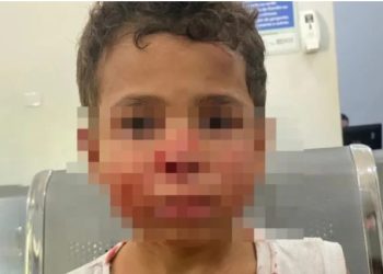 Um pit bull invadiu uma casa, matou um cachorro e deixou uma criança ferida, em Goianésia, região do Vale do São Patrício. Pitbull invade.