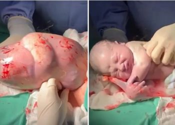 O pequeno Guilherme Auak, filho da dona de casa Katia Sousa, chegou ao mundo de uma forma única, ele nasceu empelicado em uma. Vídeo: