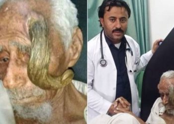 Um idoso de 140 anos, faleceu depois de uma cirurgia para remover protuberâncias retorcidas que se assemelhavam a chifres.
