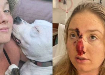 Uma mulher norte-americana teve o nariz arrancado pelo cão do namorado, da raça pitbull, depois de o animal ter assustado.