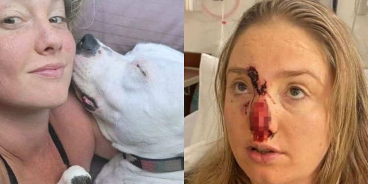 Uma mulher norte-americana teve o nariz arrancado pelo cão do namorado, da raça pitbull, depois de o animal ter assustado.