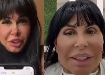 Gretchen teve o nome envolvido em uma polêmica sobre harmonização facial. Ela não costuma esconder quando realiza os procedimentos estéticos