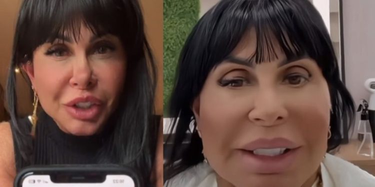 Gretchen teve o nome envolvido em uma polêmica sobre harmonização facial. Ela não costuma esconder quando realiza os procedimentos estéticos