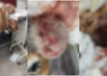 Uma idosa, que não teve o nome divulgado, está entre a vida e a morte no Hospital Platão Araújo, após ser espancada pelo filho. Idosa está