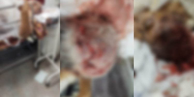 Uma idosa, que não teve o nome divulgado, está entre a vida e a morte no Hospital Platão Araújo, após ser espancada pelo filho. Idosa está