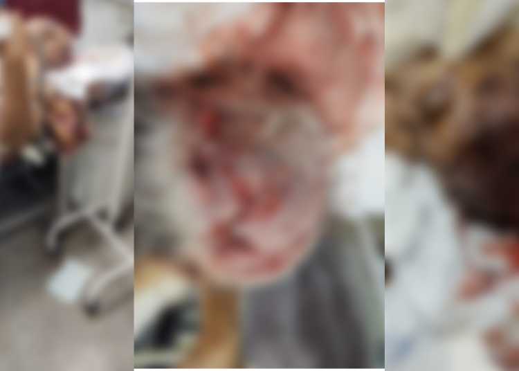 Uma idosa, que não teve o nome divulgado, está entre a vida e a morte no Hospital Platão Araújo, após ser espancada pelo filho. Idosa está