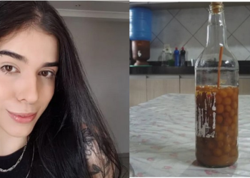 A trancista Thais Medeiros de Oliveira, 25, teve uma lesão irreversível no cérebro, segundo Rubens Dias, médico. Jovem internada