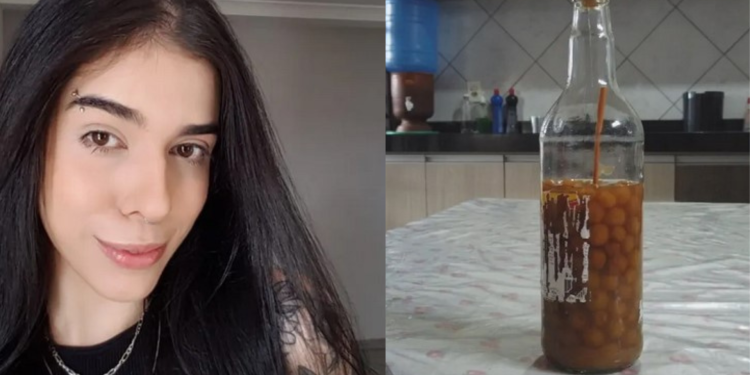 A trancista Thais Medeiros de Oliveira, 25, teve uma lesão irreversível no cérebro, segundo Rubens Dias, médico. Jovem internada