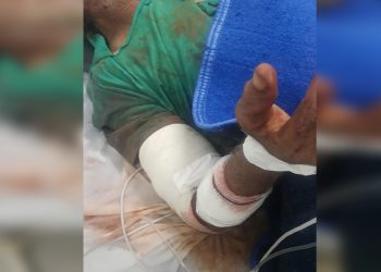 Um idoso de 62 anos teve a perna amputada após ser atacado por cães na noite de segunda-feira (6), em Severínia (SP). Idoso tem.