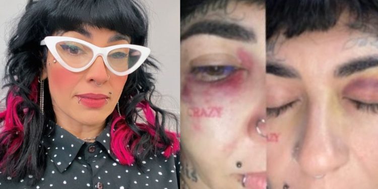 No domingo (23) a esposa de um boxeador de Manaus foi em suas redes sociais acusá-lo de agredi-la. A mulher mostrou em uma série de storys, os hematomas que ficou no seu corpo.  