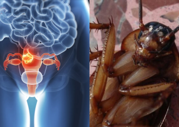 Médico encontra barata morta dentro da vagina de paciente