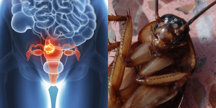 Médico encontra barata morta dentro da vagina de paciente