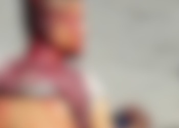 Um homem, ainda não identificado, foi esfaqueado e ficou com a faca cravada no ouvido. O caso ocorreu na manhã. Homem é