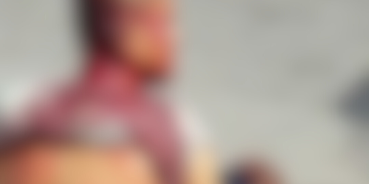 Um homem, ainda não identificado, foi esfaqueado e ficou com a faca cravada no ouvido. O caso ocorreu na manhã. Homem é