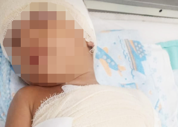 Uma explosão dentro de casa deixou uma mulher e o filho dela de apenas 2 anos com queimaduras graves, na noite de quarta-feira (26). Mãe é