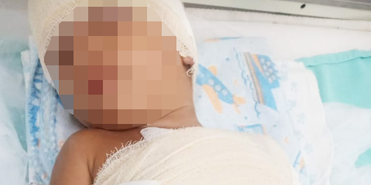 Uma explosão dentro de casa deixou uma mulher e o filho dela de apenas 2 anos com queimaduras graves, na noite de quarta-feira (26). Mãe é