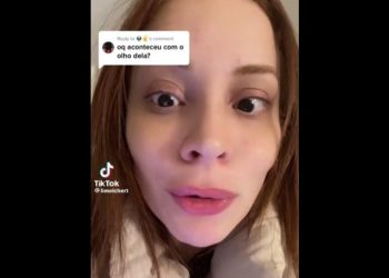 A influenciadora Lilian Melchert, de 30 anos, mostrou em suas redes sociais que contraiu um parasita carnívoro no olho esquerdo após usar lentes de contato.