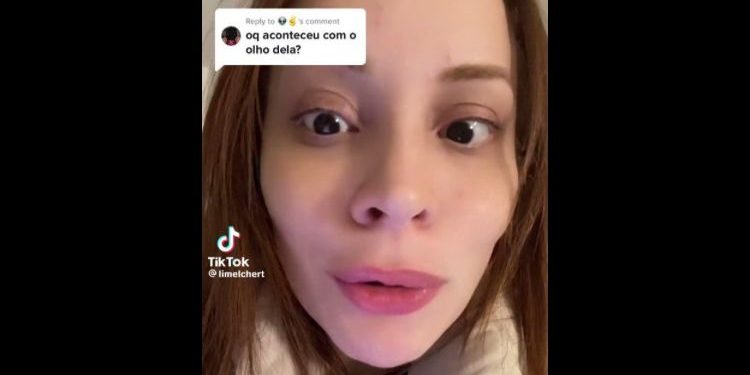 A influenciadora Lilian Melchert, de 30 anos, mostrou em suas redes sociais que contraiu um parasita carnívoro no olho esquerdo após usar lentes de contato.