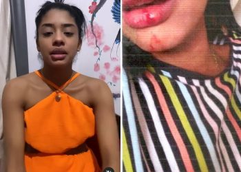 O laudo do Instituto Médico Legal (IML) confirmou que a ex-vocalista da banda Feras do Forró, Bruninha Charly, foi vítima de agressão física.