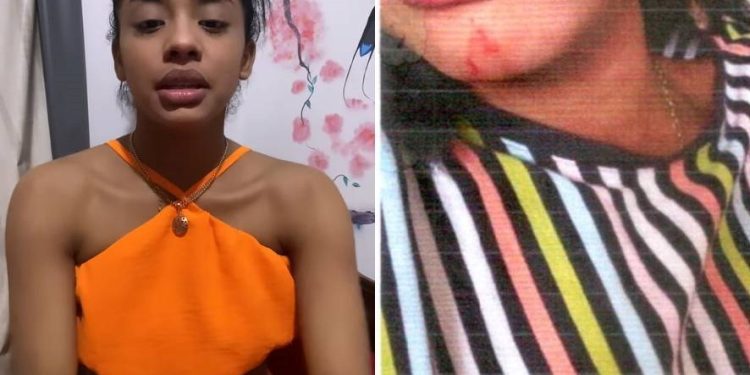 O laudo do Instituto Médico Legal (IML) confirmou que a ex-vocalista da banda Feras do Forró, Bruninha Charly, foi vítima de agressão física.