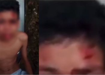Um vídeo mostra um adolescente relatando que havia sido espancado por sequestrados que o pegaram na região do bairro Manoa, em Manaus.