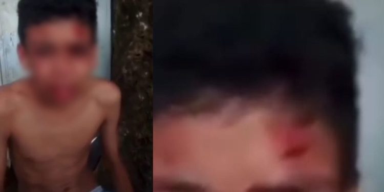 Um vídeo mostra um adolescente relatando que havia sido espancado por sequestrados que o pegaram na região do bairro Manoa, em Manaus.