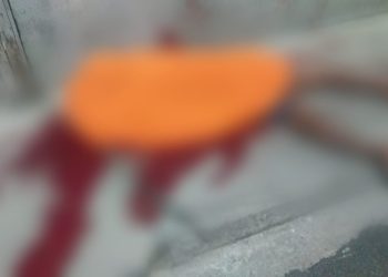 Ronald Leonardo dos Santos Pereira, conhecido 'Neguinho', 22, foi crivado de tiros por criminosos no bairro Jorge Teixeira. 