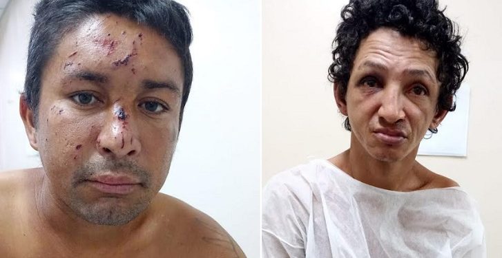 O serviço social do Hospital e Pronto-Socorro (HPS) João Lúcio Pereira Machado, unidade da Secretaria de Estado de Saúde (SES-AM), pede ajuda para encontrar os familiares de dois pacientes que estão internados na unidade. Precisando de acompanhantes