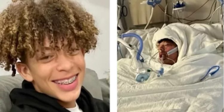 “Ele está irreconhecível”, desabafou a mãe de um adolescente de 16 anos que teve 76% do corpo queimado em razão de. Digital Influencer