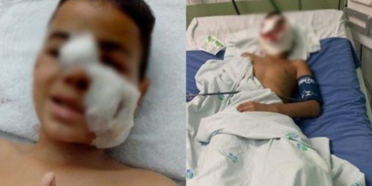 Uma criança de 10 anos foi atacada por um cachorro, da raça pit bull, e teve a orelha decepada, além de ferimentos. Criança de