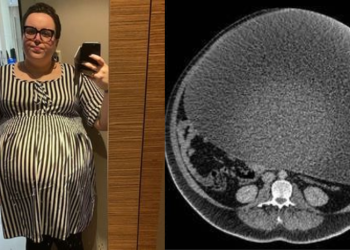 Paisley Dylan, 30, passou anos preocupada com o próprio peso. Não conseguia sair na rua sem evitar olhares estranhos. Mulher não