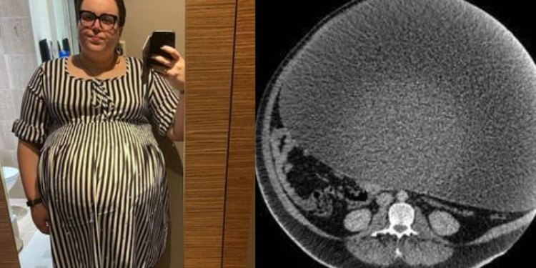 Paisley Dylan, 30, passou anos preocupada com o próprio peso. Não conseguia sair na rua sem evitar olhares estranhos. Mulher não