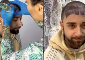 Um homem identificado por Gianluza, 26, da Itália, procurou resolver sua queda de cabelo recorrente em um estúdio de tatuagem. Homem careca