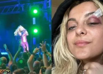 Vídeo: cantora Bebe Rexha é atingida por celular durante show