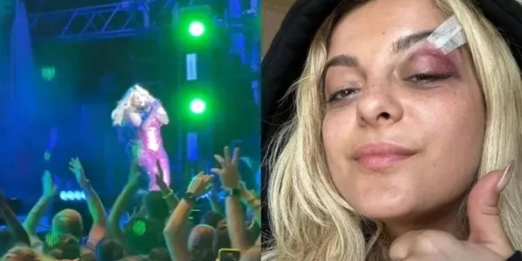 Vídeo: cantora Bebe Rexha é atingida por celular durante show