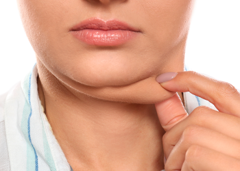 Uso excessivo do celular pode aumentar "papada"