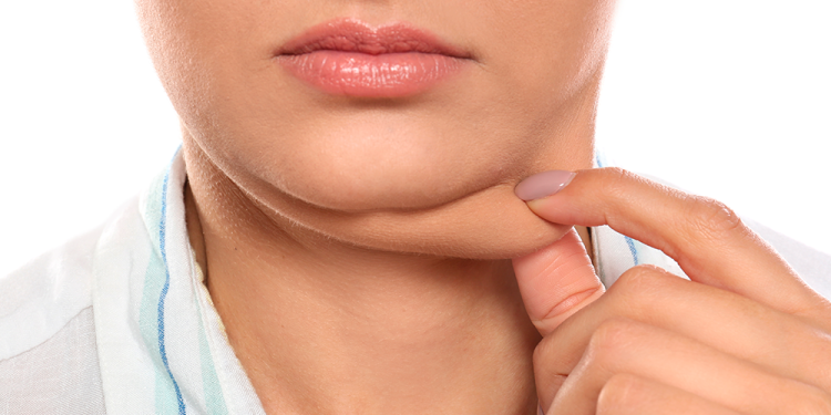 Uso excessivo do celular pode aumentar "papada"