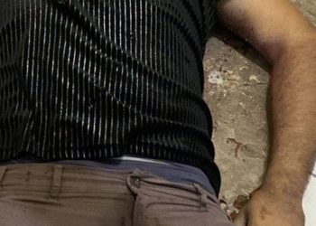 Homem é assassinado a tiros dentro de apartamento no Viver Melhor