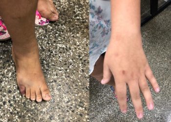 Padrasto bêbado invade a casa da ex e agride adolescente de 14 anos no bairro Mutirão, em Manaus, Amazonas.