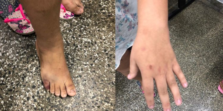 Padrasto bêbado invade a casa da ex e agride adolescente de 14 anos no bairro Mutirão, em Manaus, Amazonas.