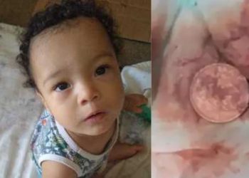 Menino de 2 anos morre após engolir moeda de 10 centavos