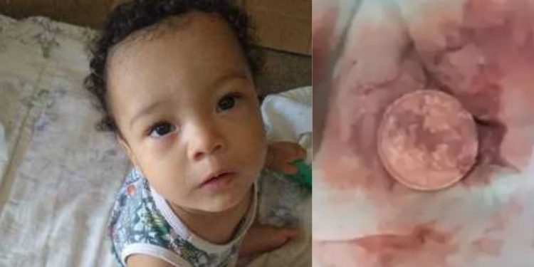 Menino de 2 anos morre após engolir moeda de 10 centavos
