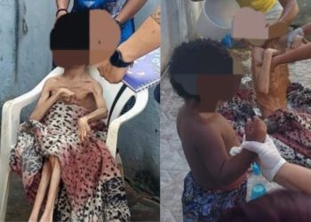 Crianças são resgatadas com sinais severos de maus-tratos em Manaus