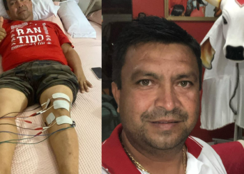 O vereador e ex-presidente do Garantido, Telo Pinto, quase teve as pernas quase esmagadas durante um acidente com uma alegoria. Ex-presidente